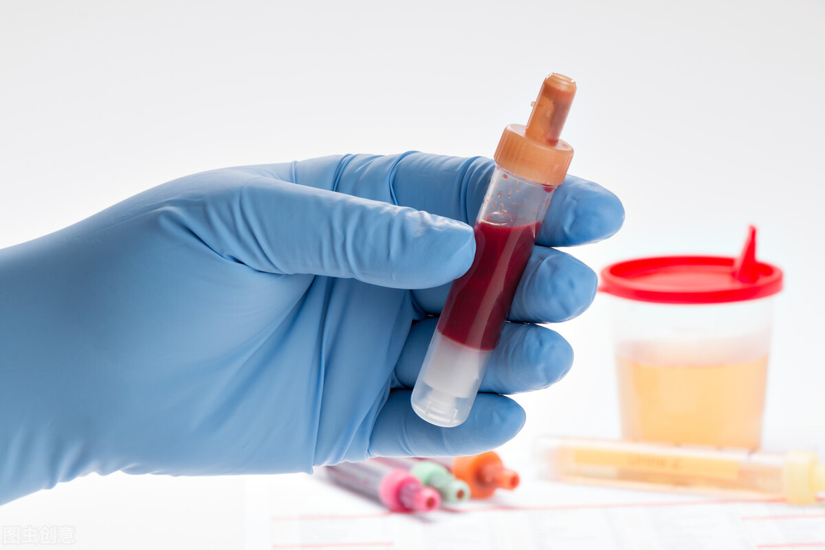 尿量少是肾病的原因吗？女性要预防肾病