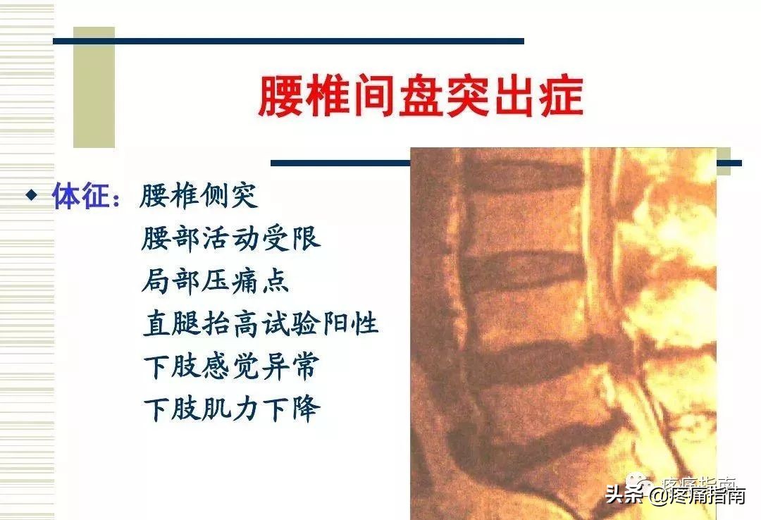 慢性疼痛常用的治疗方法,慢性疼痛常用治疗方法