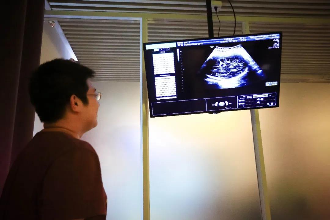 孕期检查做几次四维彩超,孕期产检需要做几次肝胆彩超