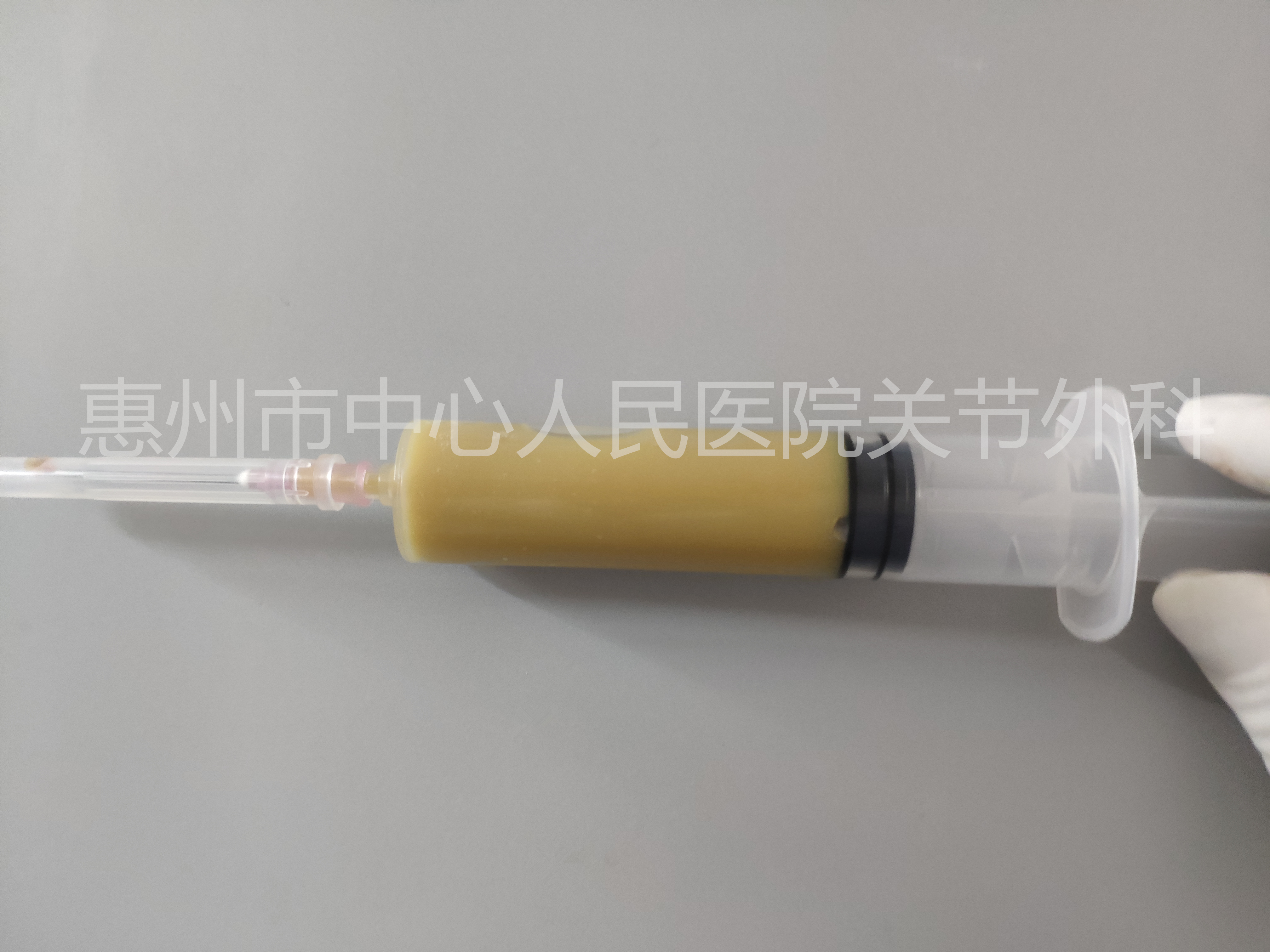 关节炎科普类短视频,化脓性关节炎怎么治疗最好最有效