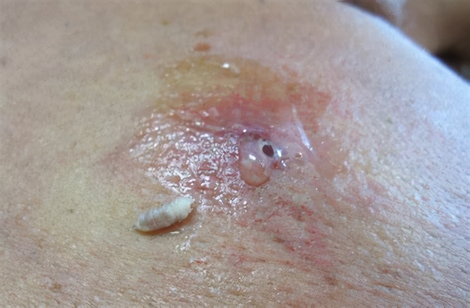 从苍蝇的贡献中得到的启示,苍蝇有哪些科学贡献