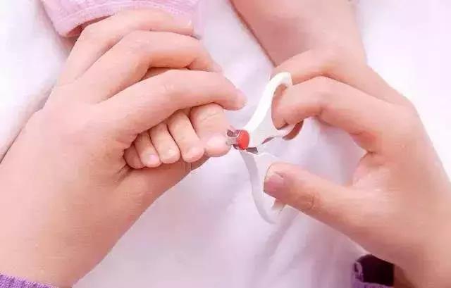 小朋友甲沟炎要拔掉整个指甲吗,小朋友甲沟炎怎么办