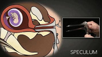 人流最多次案例,20岁女孩人流七次后续