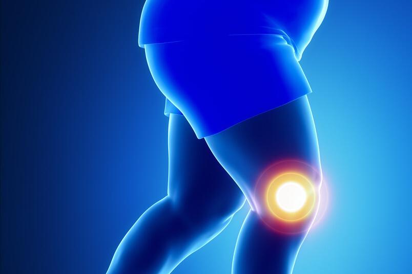 骨关节炎怎样保养与治疗,骨关节炎防治偏方