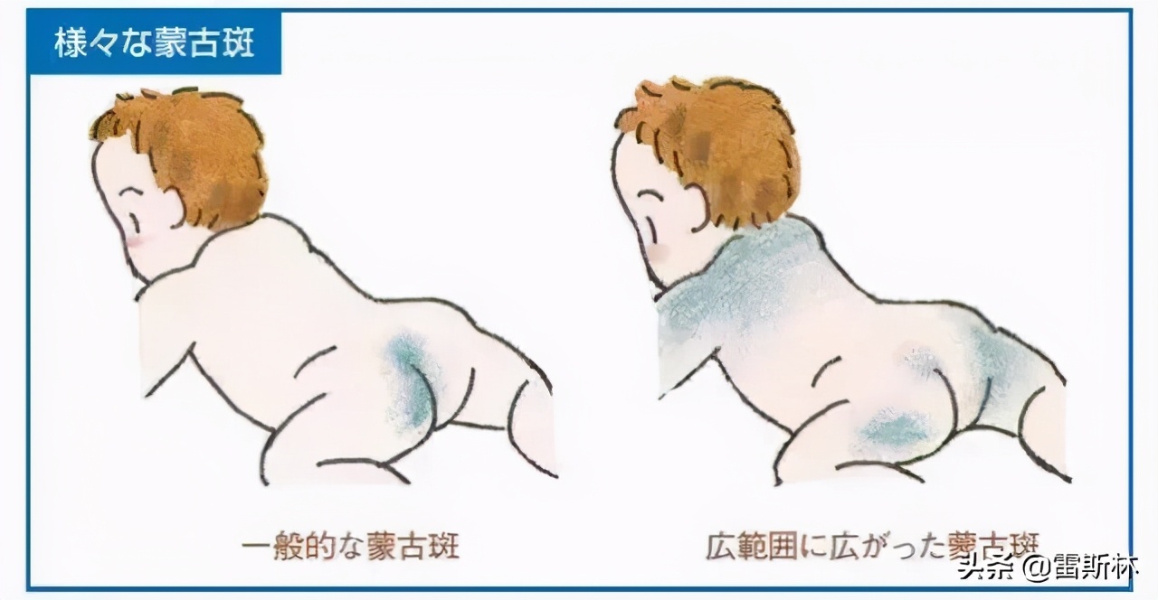 成为黄种人的优势,成为黄种人的历史