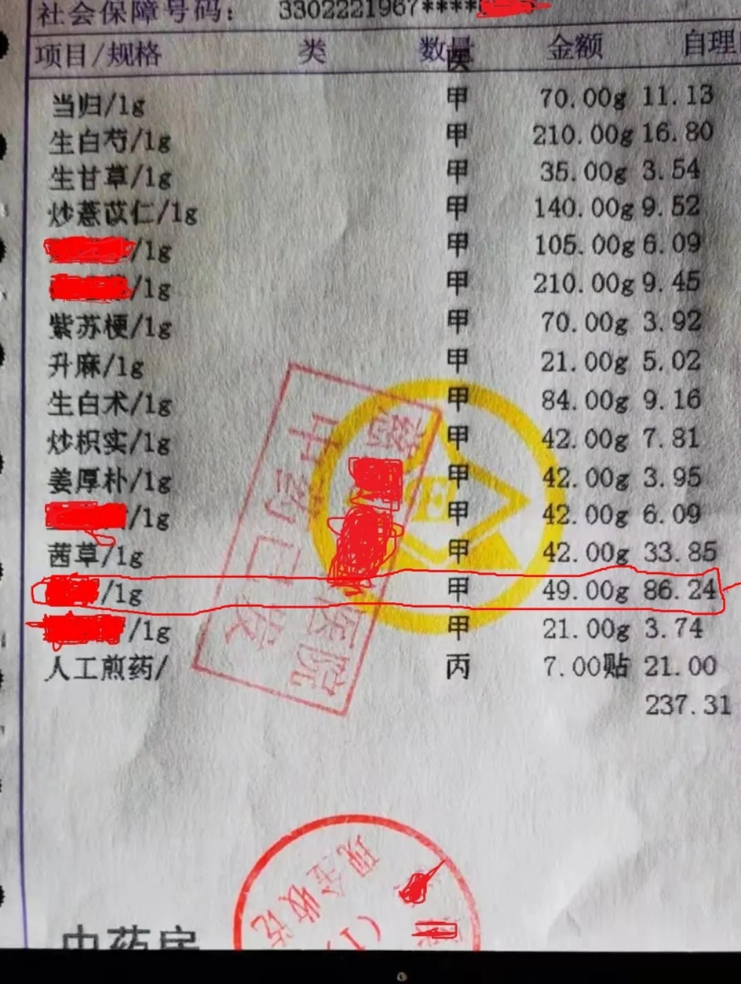 子宫腺肌症需要做诊刮吗,子宫腺肌症需要做宫腔镜检查吗