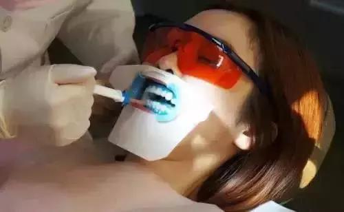 冷光美白有一次就能搞定的吗,冷光美白过程