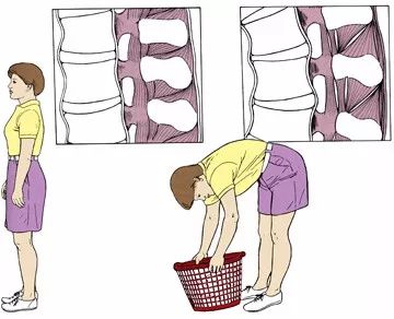 瑜伽拉伸不是拉韧带，韧带拉伤后果很严重