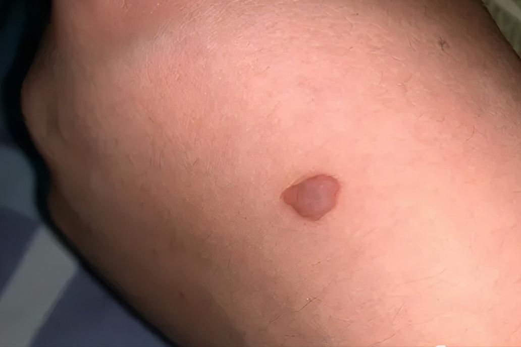 有时吓一跳什么原因,有时候吓一跳为什么