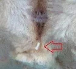 菊部边上长了个肉疙瘩,菊部周边有个白色脓包