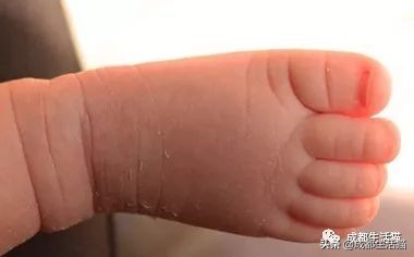 怀孕第一胎准生证怎么办理,成都东部新区准生证办理