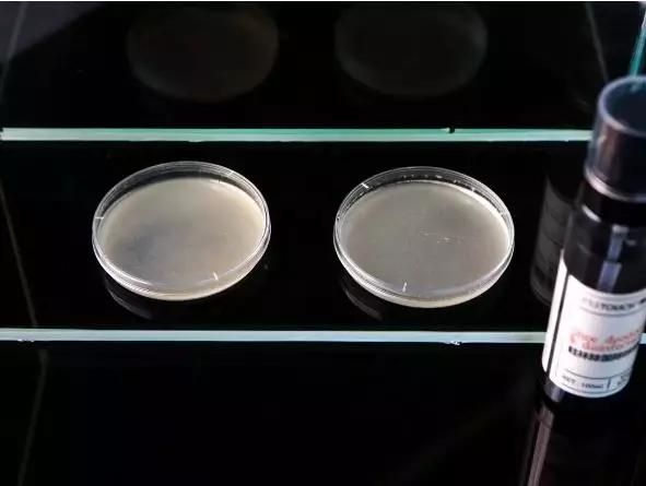 有脚臭怕被人嫌弃的样子该怎么办,老是担心自己脚臭