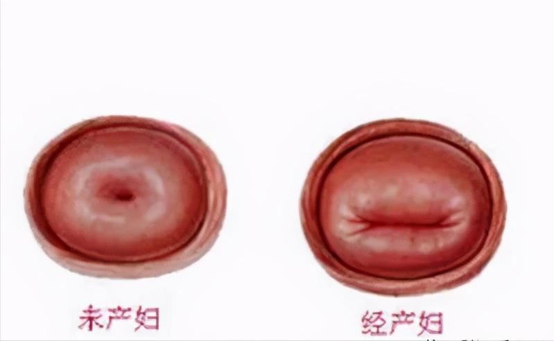 子宫复旧好了的症状,子宫复旧恢复过程