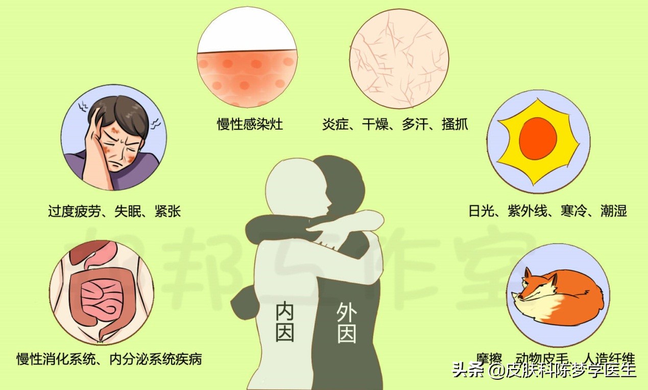 湿疹痒痒痒，该如何分期治疗？