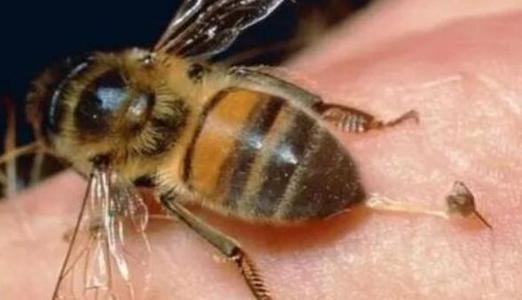 蜂蜇伤急救处理的方法,蜂蜇伤急救处理方法