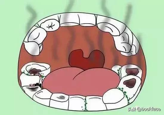 会传染的口臭属于什么口臭,和女朋友接吻自己有口臭怎么办