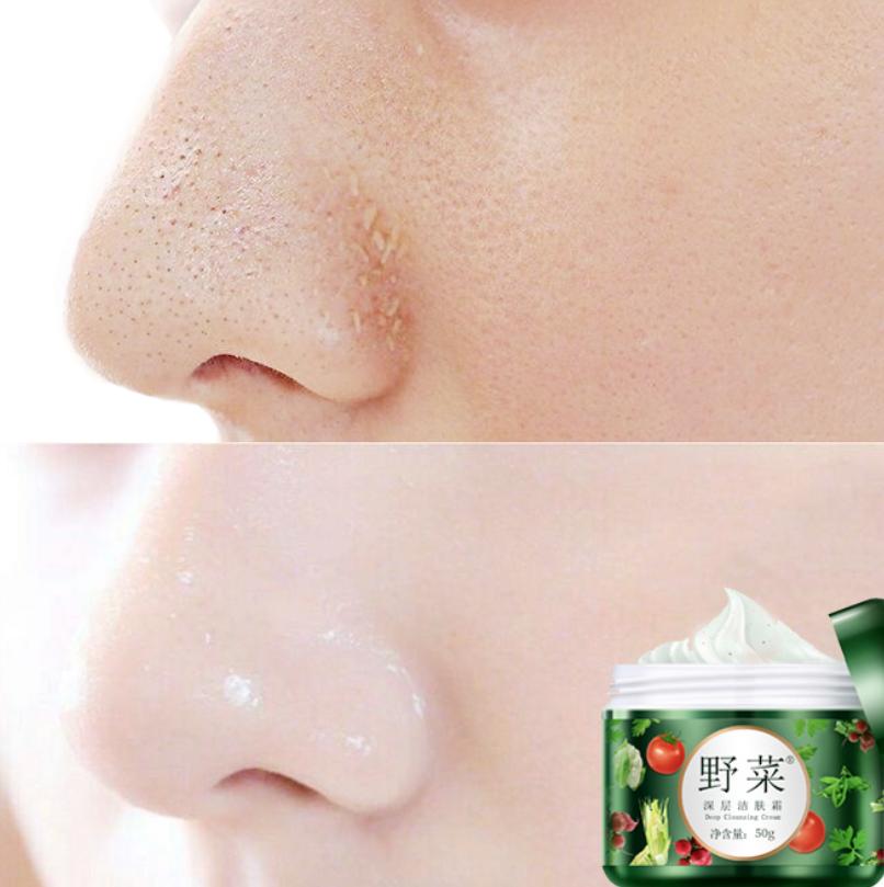 黑头疯长,口罩一摘吓死人?用它揉一揉,毛孔垃圾全吸走