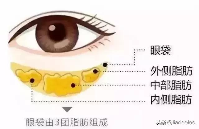 眼角皱纹最显老要注意防晒,眼角皱纹去皱最有效的方法