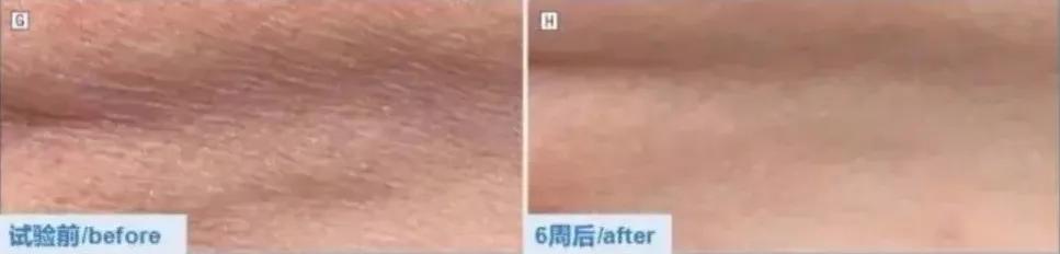 抗老全攻略20岁女生就不用抗老吗,不同年龄阶段抗老攻略