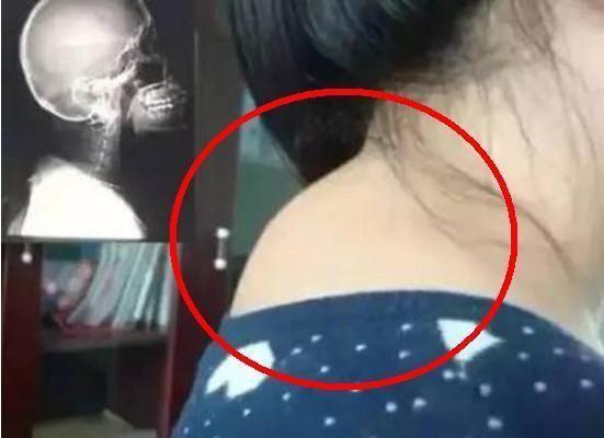 富贵包和胖有什么区别,富贵包是胖的吗