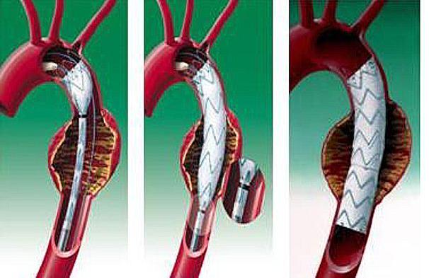 太平人寿《福禄嘉倍》快停售了，真的值得抢购吗？