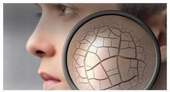 靶向药引起皮肤溃烂擦什么药膏好,靶向药导致的皮肤毒性该怎么治疗