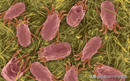 后背痘印的原因和解决方法,后背长痘痘印怎么消除最快最有效