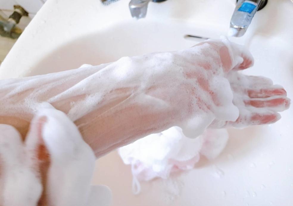 30年前人人身上都有的虱子,30年前人人都有虱子为啥现在消失