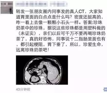 珍珠奶茶里的珍珠能被消化吗,珍珠奶茶会形成结石吗