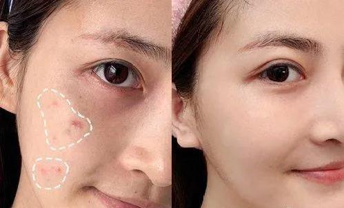 薰衣草精油对皮肤的功效,薰衣草精油保湿提亮肤色