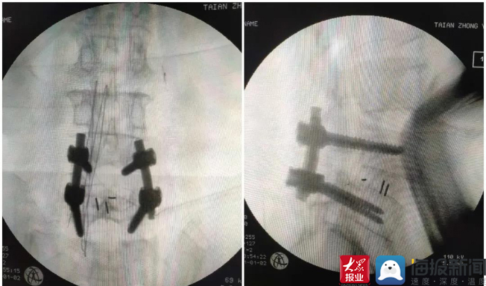 鑴婃煴寰垱鎵嬫湳璁惧,鑴婃煴鎵嬫湳鍏堣繘璁惧