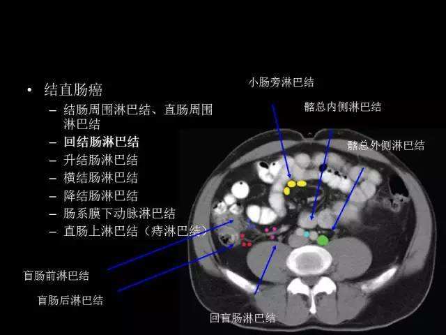 癌症已转移化疗有效吗,癌症有转移还有手术必要吗