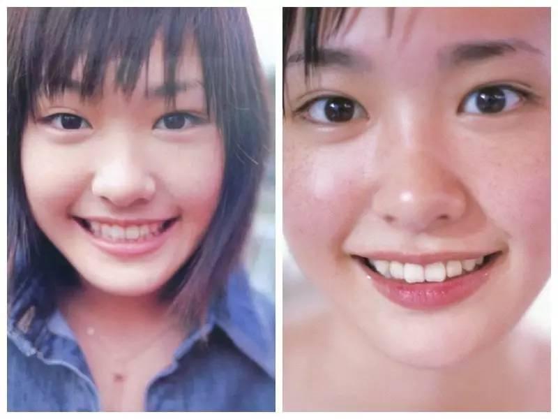 日本整容惊人案例,日本整容是不是最先进