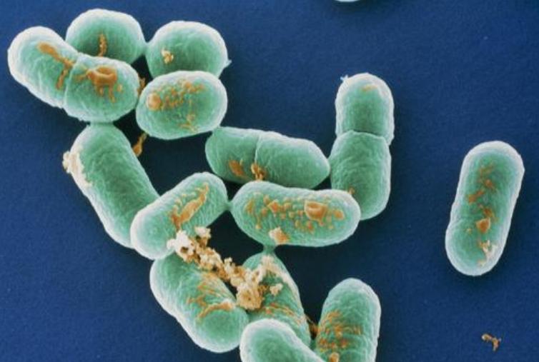 喝了孕妇奶粉肚子疼是怎么了,喝了孕妇奶粉心里难受