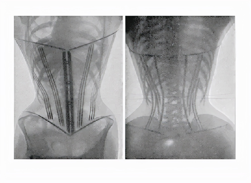 产后九年了漏尿能修复吗,产后修复做完还漏尿怎么回事