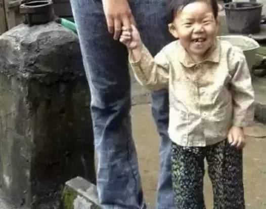 世界最丑男人奇闻异事,世界上最丑的女人背后故事