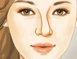 硅胶假体隆鼻透光怎么遮,硅胶隆鼻后鼻子反复肿