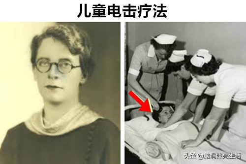 十大灭绝人性的人体实验,历史上最恐怖五项人体实验