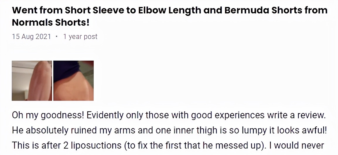 抽脂减肥成了植物人,整形抽脂死亡