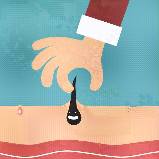 体毛脱毛的最佳方法,体毛怎么脱毛最快最有效