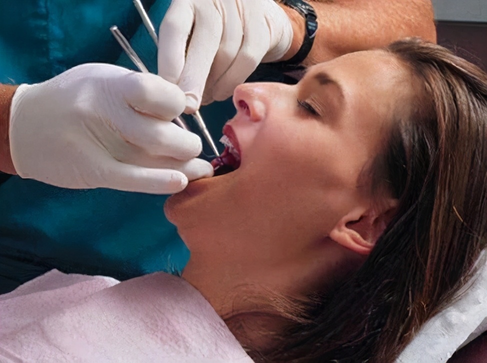 拔牙10天了还会得干槽症吗,拔牙之后干槽症疼痛会持续多久