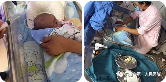 昭通第一人民医院早产儿科,昭通市第一人民医院儿外科