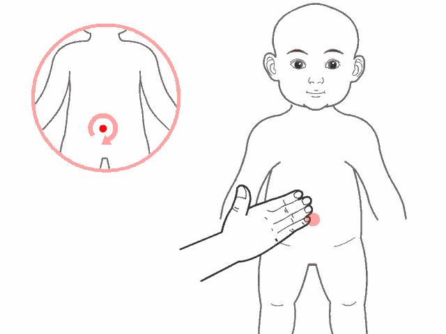 孩子发烧咳嗽腹胀便秘,宝宝积食发烧还咳嗽厉害