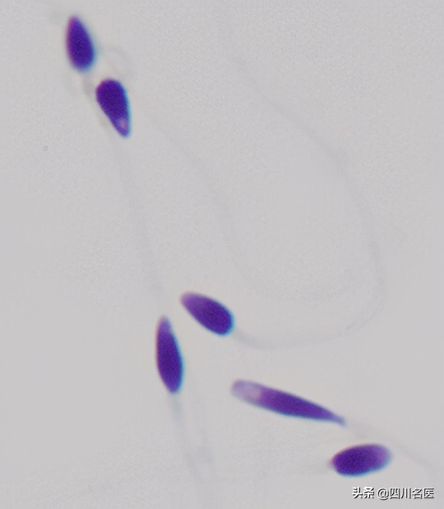 精子是如何产生的百科,精子是不是每天都能生成