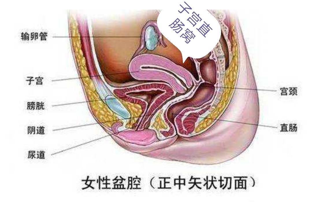 女性盆腔积液腹痛用什么药最好,女人之痛是什么