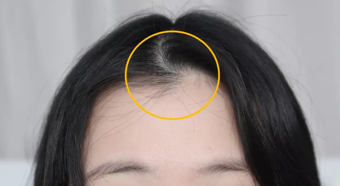 刘海怎么才能矫正,刘海矫正最好的方法