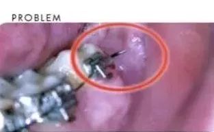 非常时期非常处理,非常时期全力守护