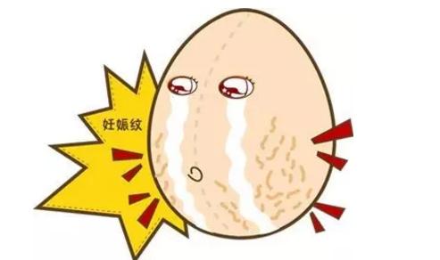 妊娠纹谁都会长吗,妊娠纹厉害的是不是疤痕体质