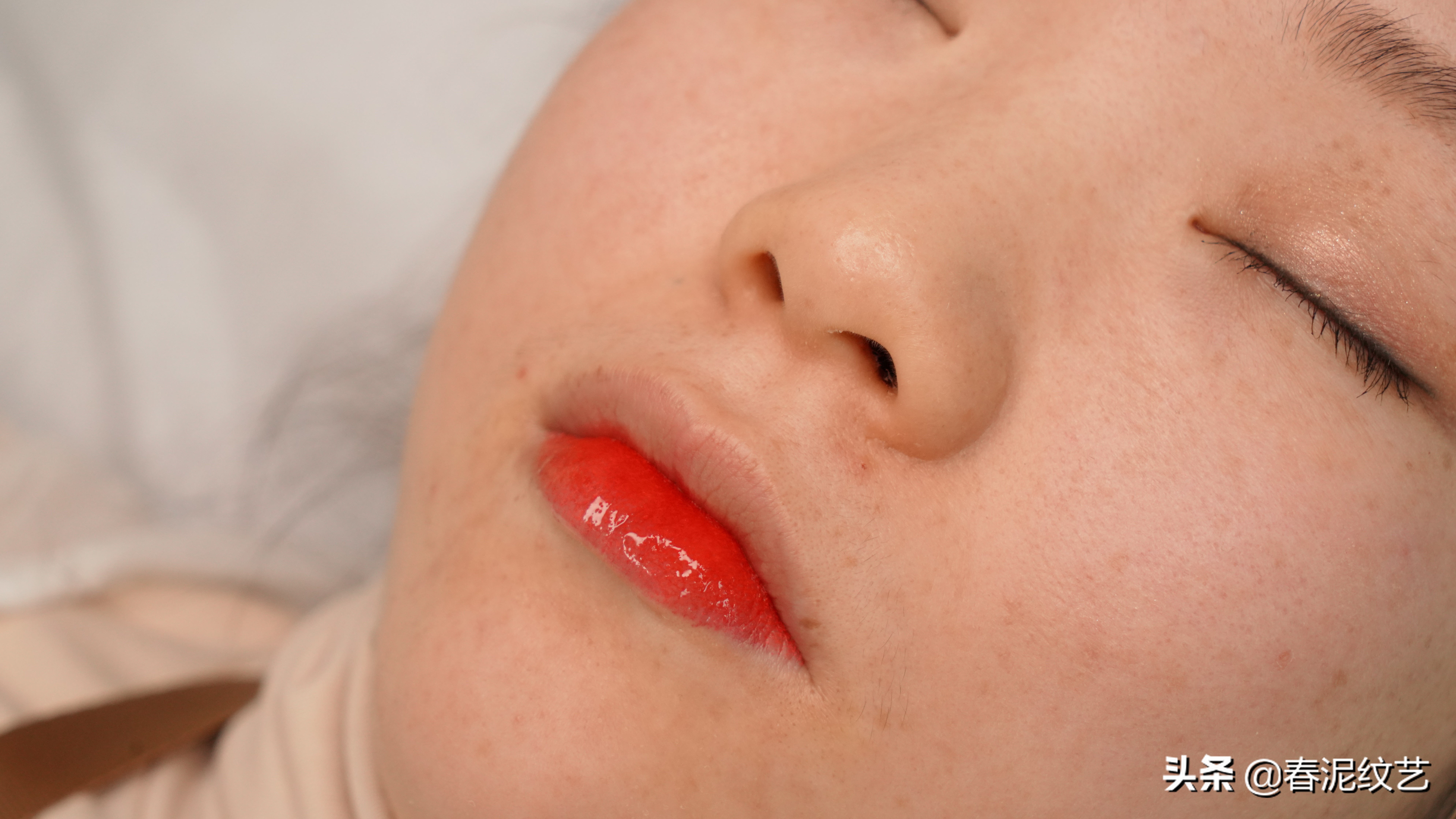 顾客纹唇后不忌口，起泡了怎么办？