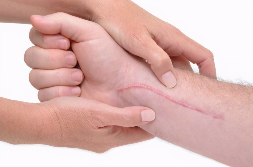 白色的凸起的疤痕增生怎么治,白色凸起疤痕是什么